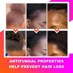 Fast Hair Growth Set Chebe Oil Traction Alopecia Hair Mask Anti Break Loss Hair Growth Oil Baldness Treatment Beauty Hair Care